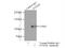 Forkhead Box M1 antibody, 13147-1-AP, Proteintech Group, Immunoprecipitation image 