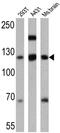 Cadherin 3 antibody, GTX19350, GeneTex, Western Blot image 