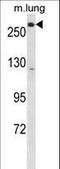 Low-density lipoprotein receptor-related protein 5 antibody, LS-C165868, Lifespan Biosciences, Western Blot image 