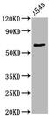 Protein Kinase C Zeta antibody, CSB-RA018710A560phHU, Cusabio, Western Blot image 