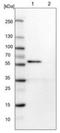 Calcium/Calmodulin Dependent Protein Kinase II Beta antibody, NBP1-88212, Novus Biologicals, Western Blot image 