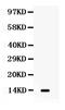 Lymphotactin antibody, PB9681, Boster Biological Technology, Western Blot image 