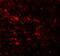 Epithelial Splicing Regulatory Protein 1 antibody, NBP1-76536, Novus Biologicals, Immunofluorescence image 