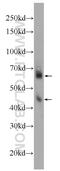Glutamate-Ammonia Ligase antibody, 11037-2-AP, Proteintech Group, Western Blot image 
