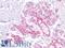 Keratin 17 antibody, LS-B16078, Lifespan Biosciences, Immunohistochemistry paraffin image 