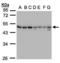 Gamma-Aminobutyric Acid Type A Receptor Beta1 Subunit antibody, orb89979, Biorbyt, Western Blot image 