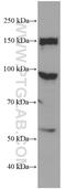 Properdin antibody, 66788-1-Ig, Proteintech Group, Western Blot image 