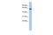 LEM Domain Containing 2 antibody, GTX45192, GeneTex, Western Blot image 