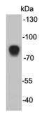 Mannan Binding Lectin Serine Peptidase 2 antibody, NBP2-66941, Novus Biologicals, Western Blot image 