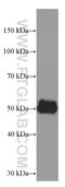 Angiotensin II type-1 receptor antibody, 66415-1-Ig, Proteintech Group, Western Blot image 