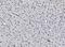 Cell Cycle And Apoptosis Regulator 2 antibody, A03412-1, Boster Biological Technology, Immunohistochemistry paraffin image 
