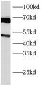 FDC-signaling molecule 8D6 antibody, FNab01466, FineTest, Western Blot image 