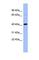 Complement Factor Properdin antibody, NBP1-58974, Novus Biologicals, Western Blot image 