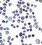 Inositol Polyphosphate-4-Phosphatase Type II B antibody, NBP2-82096, Novus Biologicals, Immunocytochemistry image 