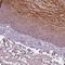 Kallikrein Related Peptidase 13 antibody, NBP2-49358, Novus Biologicals, Immunohistochemistry frozen image 