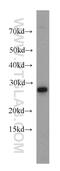Coiled-Coil-Helix-Coiled-Coil-Helix Domain Containing 6 antibody, 20639-1-AP, Proteintech Group, Western Blot image 