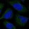 Centromere Protein M antibody, HPA042404, Atlas Antibodies, Immunocytochemistry image 