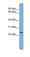 THAP Domain Containing 6 antibody, orb330696, Biorbyt, Western Blot image 