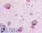 Glycogen Phosphorylase B antibody, LS-A2282, Lifespan Biosciences, Immunohistochemistry paraffin image 