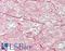 Neurofilament Medium antibody, LS-B11174, Lifespan Biosciences, Immunohistochemistry frozen image 