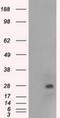 N-Acetyltransferase 8 (Putative) antibody, NBP1-47863, Novus Biologicals, Western Blot image 