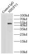 NADH:Ubiquinone Oxidoreductase Core Subunit V1 antibody, FNab05635, FineTest, Immunoprecipitation image 