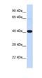 Heat Shock Transcription Factor 2 Binding Protein antibody, orb324578, Biorbyt, Western Blot image 