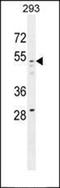 NFKB Inhibitor Alpha antibody, orb214311, Biorbyt, Western Blot image 