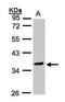 O-Sialoglycoprotein Endopeptidase antibody, GTX105808, GeneTex, Western Blot image 