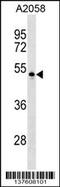 Nectin Cell Adhesion Molecule 4 antibody, 59-518, ProSci, Western Blot image 