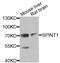 Serine Peptidase Inhibitor, Kunitz Type 1 antibody, abx004905, Abbexa, Western Blot image 