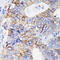 Integrin Subunit Alpha 2 antibody, GTX02835, GeneTex, Immunohistochemistry paraffin image 