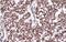 Estrogen Receptor 2 antibody, NB200-305, Novus Biologicals, Immunohistochemistry paraffin image 