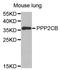Protein Phosphatase 2 Catalytic Subunit Beta antibody, STJ29902, St John
