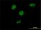 TSC22 Domain Family Member 4 antibody, H00081628-M08, Novus Biologicals, Immunocytochemistry image 