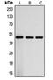 Arrestin Domain Containing 3 antibody, MBS821518, MyBioSource, Western Blot image 