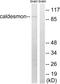 CALD1 antibody, LS-C118351, Lifespan Biosciences, Western Blot image 