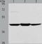 Acyl-CoA Dehydrogenase Short Chain antibody, TA321036, Origene, Western Blot image 