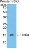 Inhibin Subunit Beta A antibody, LS-C303703, Lifespan Biosciences, Western Blot image 