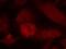 Insulin Receptor Substrate 1 antibody, 79-589, ProSci, Immunofluorescence image 