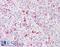 Tet Methylcytosine Dioxygenase 2 antibody, 42-198, ProSci, Immunohistochemistry frozen image 