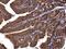 Phosphoinositide-3-Kinase Regulatory Subunit 4 antibody, PA5-78488, Invitrogen Antibodies, Immunohistochemistry paraffin image 