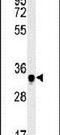 SWIM-Type Zinc Finger 7 Associated Protein 1 antibody, PA5-25460, Invitrogen Antibodies, Western Blot image 