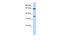 General Transcription Factor IIB antibody, 27-121, ProSci, Western Blot image 