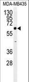 Endoplasmic Reticulum Oxidoreductase 1 Beta antibody, LS-B10234, Lifespan Biosciences, Western Blot image 