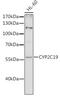 Cytochrome P450 Family 2 Subfamily C Member 19 antibody, 16-545, ProSci, Western Blot image 