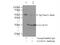 Galectin 3 antibody, 14979-1-AP, Proteintech Group, Immunoprecipitation image 