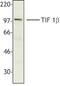 Tripartite Motif Containing 28 antibody, TA328012, Origene, Western Blot image 
