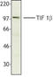 KAP-1 antibody, TA328012, Origene, Western Blot image 