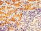 Ornithine Carbamoyltransferase antibody, LS-C370087, Lifespan Biosciences, Immunohistochemistry paraffin image 